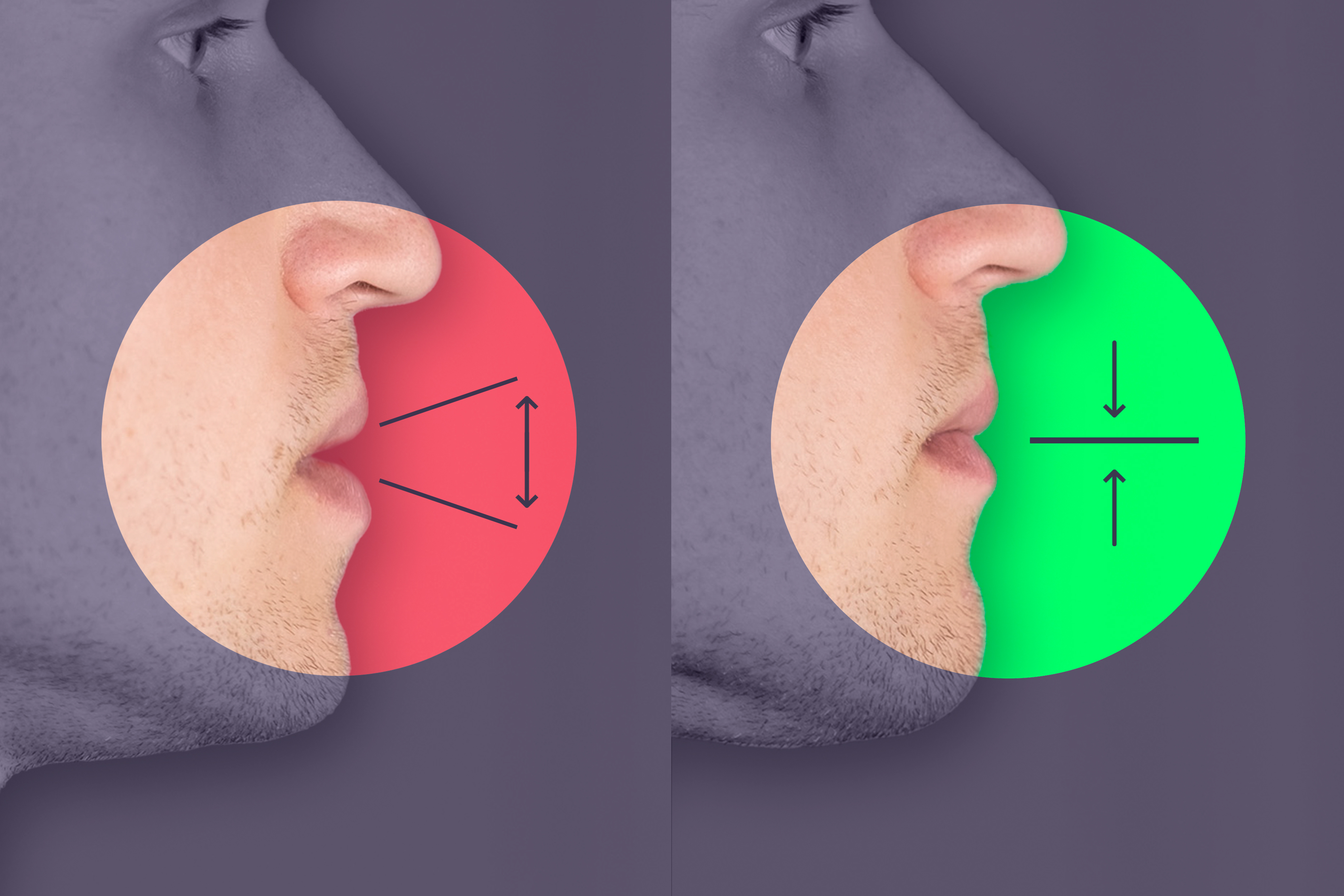 Mewing Correct Lips Position